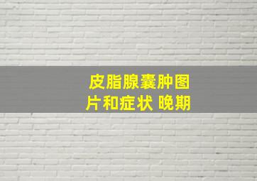 皮脂腺囊肿图片和症状 晚期